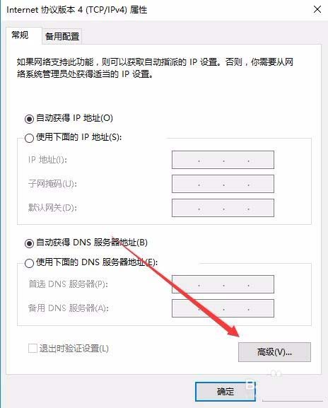 Win10怎么启用Tcp/IP上的netbios网络协议?