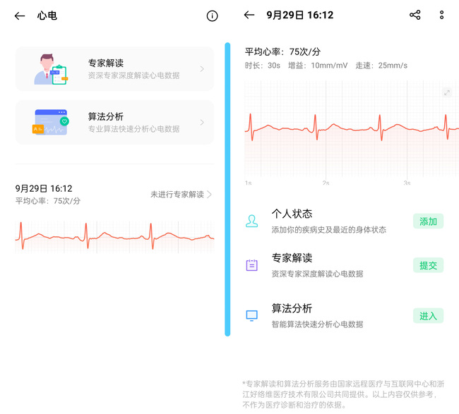OPPO Watch ECG版体验如何 OPPO Watch ECG版体验评测