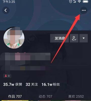 抖音关注的人怎么添加备注?