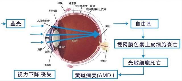 护眼显示器有用吗 护眼显示器效果介绍