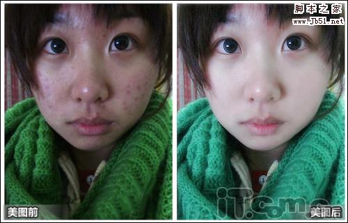  美图秀秀教程 一分钟除痘法 无痘素颜也美丽