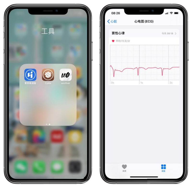 Apple Watch国行版越狱后如何激活ECG功能?