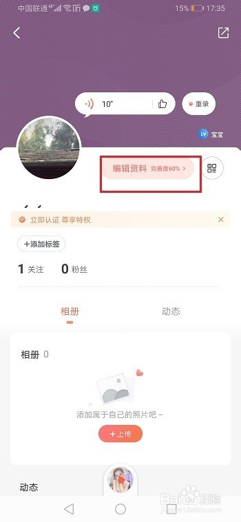 喜马拉雅怎么绑定微博？喜马拉雅绑定微博教程