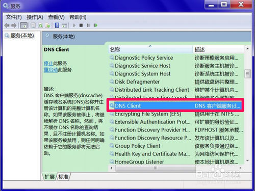 网络诊断提示DNS服务器未响应该怎么办？dns服务器未响应解决方法