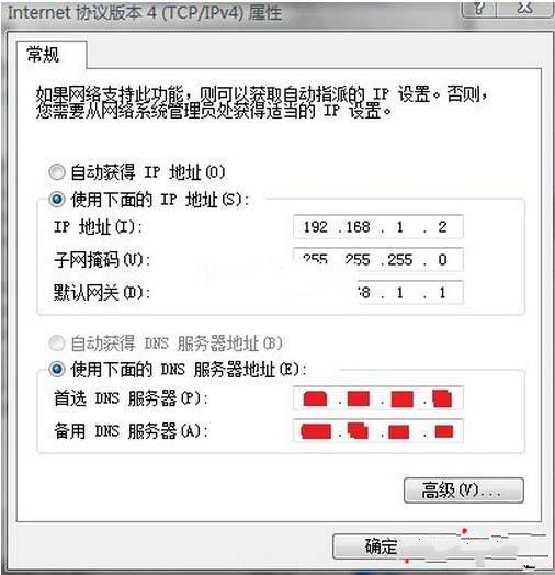 Win7中进行本地连接后显示未识别网络无Internet访问的解决方法