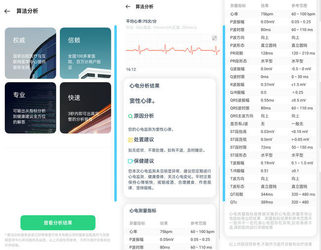 OPPO Watch ECG版体验如何 OPPO Watch ECG版体验评测