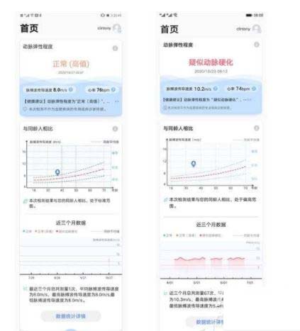 GT2pro时尚款和ECG版区别大吗 GT2pro时尚款和ECG版对比介绍