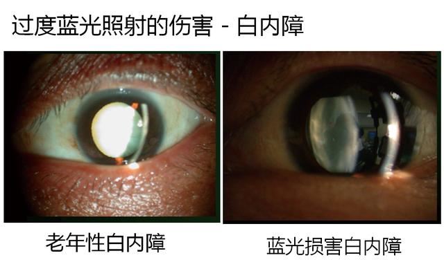 护眼显示器有用吗 护眼显示器效果介绍