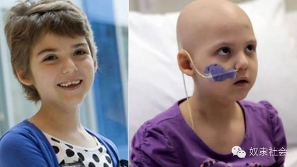 CAR-T免疫疗法,治愈癌症不是梦