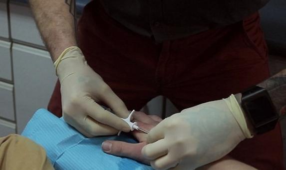 当黑客在体内植入9块芯片后，&ldquo;终结者&rdquo;要来了？