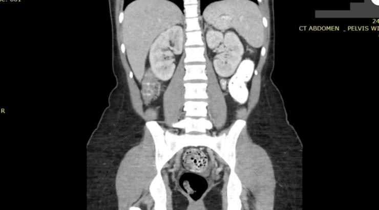 数十亿张医学图像暴露在互联网，波及美国最大军事医院。。。