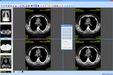 Sante DICOM Viewer FREE 4.0.14截图