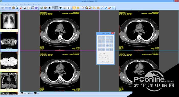 Sante DICOM Viewer FREE 4.0.14截图