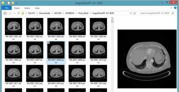 DICOM Thumbnailer(dicom缩略图查看工具) 1.7.0 正式版 DICOM Thumbnailer(dicom缩略图查看工具)