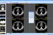 Sante DICOM Viewer FREE 4.0.14