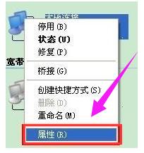 怎么解决电脑本地连接受限制或无连接