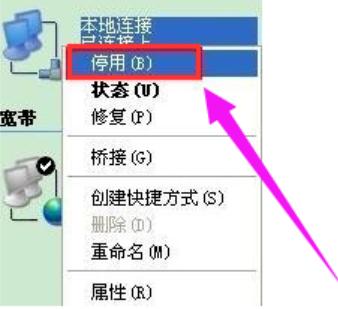 本地连接受限制,小编教你如何解决电脑本地连接受限制
