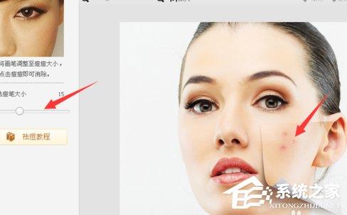美图秀秀怎么去除痘痘?美图秀秀去除痘痘的方法