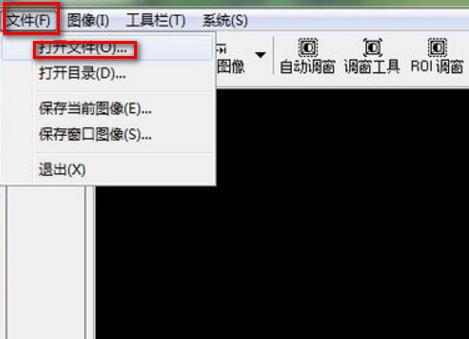 dcm文件怎么打开?dcm文件用什么软件可以打开?