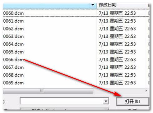 dcm文件怎么打开?dcm文件用什么软件可以打开?
